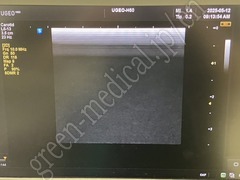 SAMSUNG Ultrasound Color Doppler