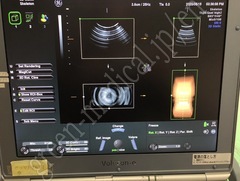 GE Healthcare Portable Ultrasound