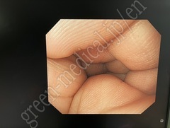 OLYMPUS Video Gastroscope