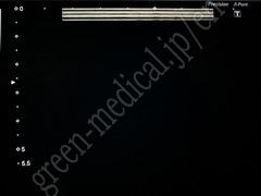 TOSHIBA Ultrasound Color Doppler