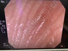 OLYMPUS Video Colonoscope
