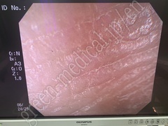 OLYMPUS Video Gastroscope