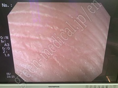 OLYMPUS Video Gastroscope
