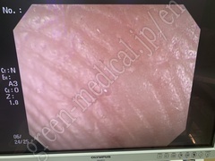 OLYMPUS Video Gastroscope