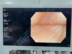 OLYMPUS Video Colonoscope