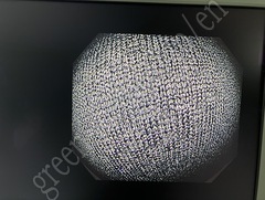 OLYMPUS Video Colonoscope
