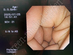 OLYMPUS Video Gastroscope