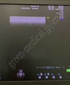 GE Healthcare Diagnostic Ultrasound System