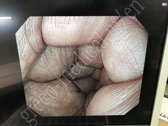 OLYMPUS Processor & Xenon Lightsource