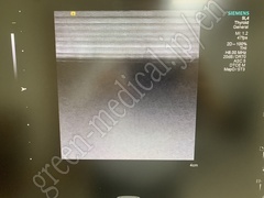 SIEMENS 4D Ultrasound System