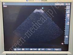 SonoSite Ultrasound Color Doppler