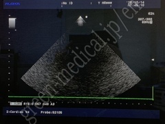Hitachi Ultrasound Color Doppler