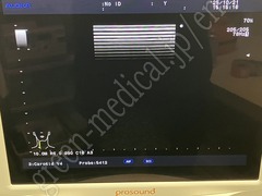 Hitachi Ultrasound Color Doppler