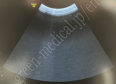 GE Healthcare Diagnostic Ultrasound System