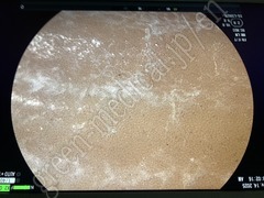 FUJIFILM Video Gastroscope