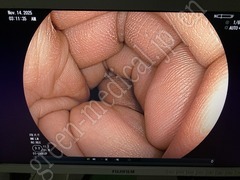 FUJIFILM Video Colonoscope