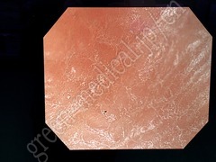 OLYMPUS Video Colonoscope