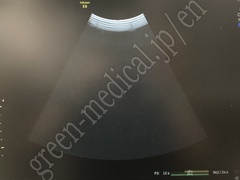 GE Healthcare Diagnostic Ultrasound System