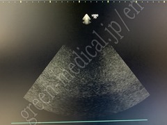 GE Healthcare Diagnostic Ultrasound System