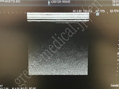 Hitachi Diagnostic Ultrasound System