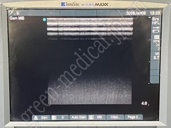 SonoSite Ultrasound Color Doppler