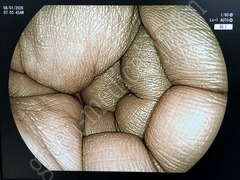 FUJIFILM Processor & Laser Lightsource