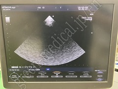 Hitachi Color Doppler Ultrasound System