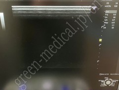 GE Healthcare Diagnostic Ultrasound System