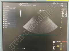 GE Healthcare Ultrasound Color Doppler