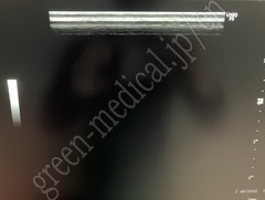 GE Healthcare Diagnostic Ultrasound System