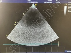 GE Healthcare Portable Ultrasound Color Doppler