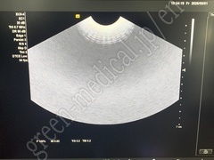 SIEMENS Diagnostic Ultrasound System