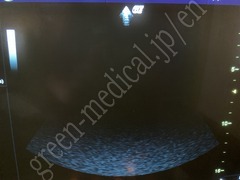 GE Healthcare Ultrasound Color Doppler