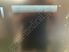 GE Healthcare Ultrasound Color Doppler