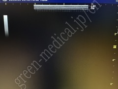 GE Healthcare Ultrasound Color Doppler