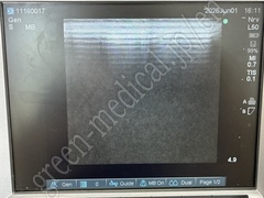 SonoSite Ultrasound Color Doppler