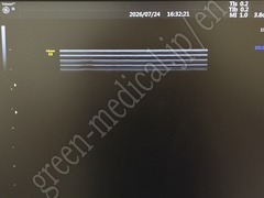 GE Healthcare 4D Ultrasound Color Doppler