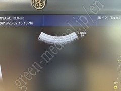 GE Healthcare Ultrasound Color Doppler