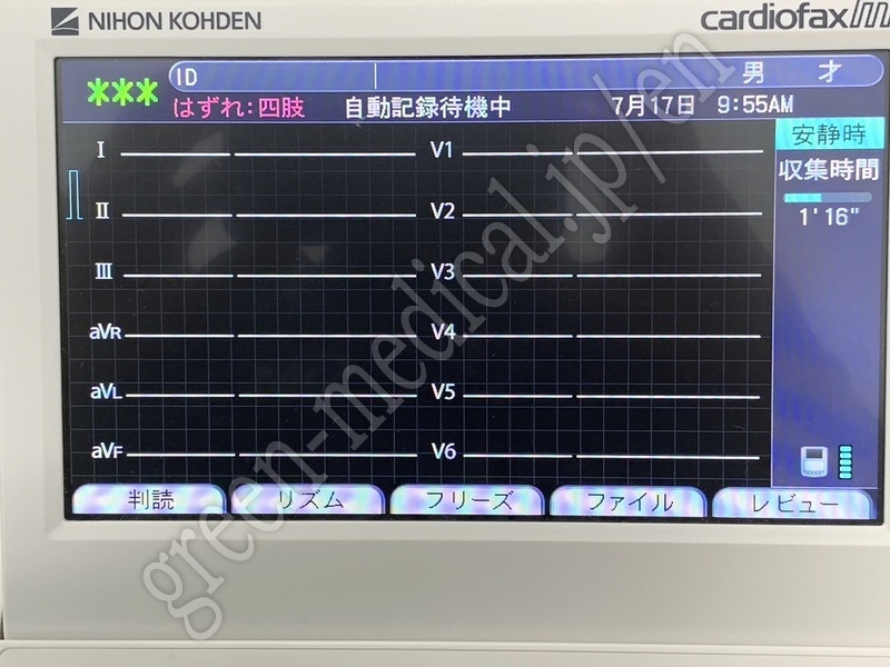 3.〇心電計