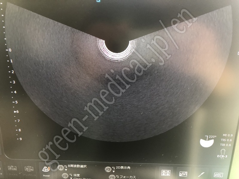 3.○ 超音波診断装置（カラー）