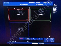 PHILIPS Ultrasound Color Doppler