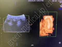 GE Healthcare Diagnostic Ultrasound System