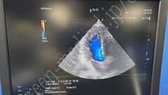 Hitachi Diagnostic  Ultrasound System