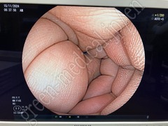 FUJIFILM Video Colonoscope