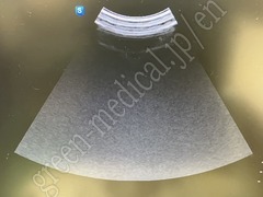 SAMSUNG Ultrasound Color Doppler