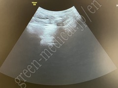 GE Healthcare Diagnostic Ultrasound System
