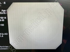 OLYMPUS Video Colonoscope