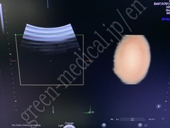 GE Healthcare Diagnostic Ultrasound System