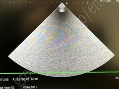 Hitachi Ultrasound Diagnostic System