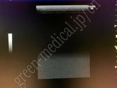 GE Healthcare Ultrasound Color Doppler